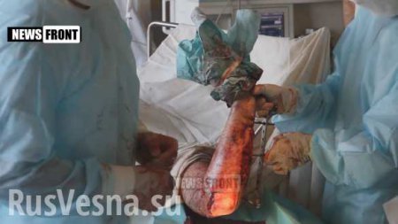 Медики ЛНР спасают руку мужчины, оторванную во время обстрела нацистами Первомайска (ВИДЕО +18)